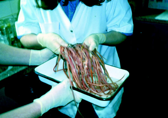 BEHOLD THE LARGE ROUNDWORM ( Ascaris ) Worms