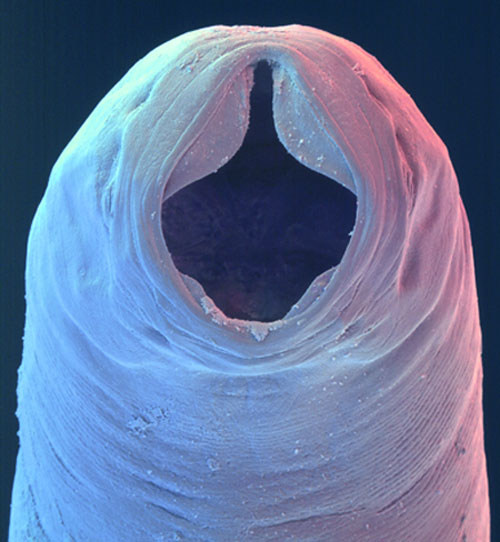 HOOKWORM HEAD SHOT Worms