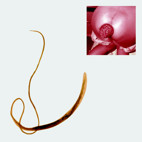 WHOA, A WHIPWORM Worms