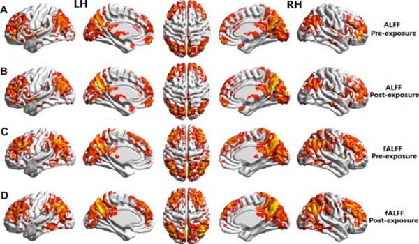 First Study on 4G LTE Cell Phone Radiation Shows It Affects Brain Activity