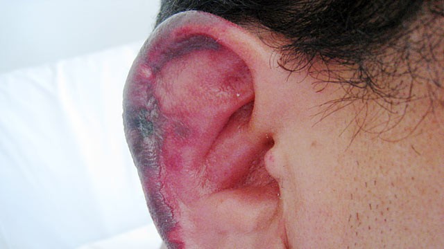 PHOTO: The veterinary drug can rot the flesh of the nose and ears